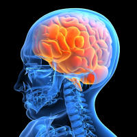 Human Brain X-Ray Image
